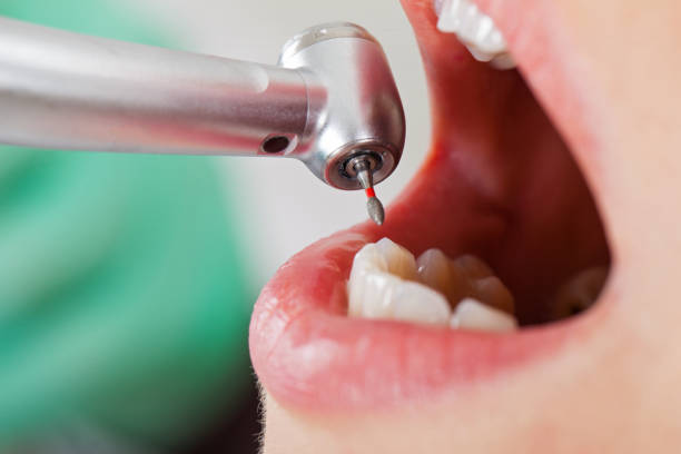 Best Emergency Dental Care for Trauma or Injury in Mariposa, CA